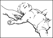 infant1